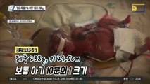 ‘생존확률 1% 미만’ 뚫은 288g…팔팔이 건우가 일군 기적