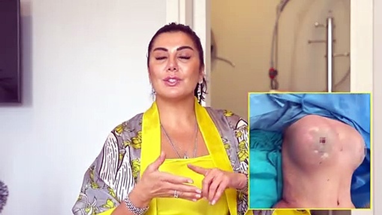 DOĞUM SONRASI MEME ESTETİĞİ NE ZAMAN YAPILABİLİR_!