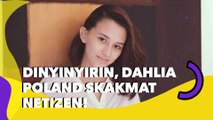 Wajah Dinyinyiri Penuh Komedo, Dahlia Poland Skakmat Netizen!