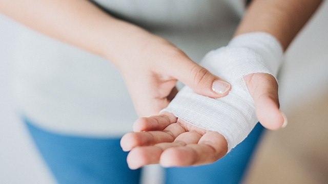 Atasi Luka Bakar Ringan dengan Bahan-bahan Ini