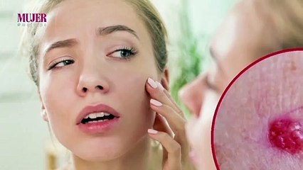 Conoce tu piel - Nex Panamá