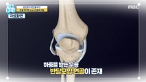 [HEALTHY] Cartilage without blood vessels. Once it's broken, it's over., 기분 좋은 날 210909