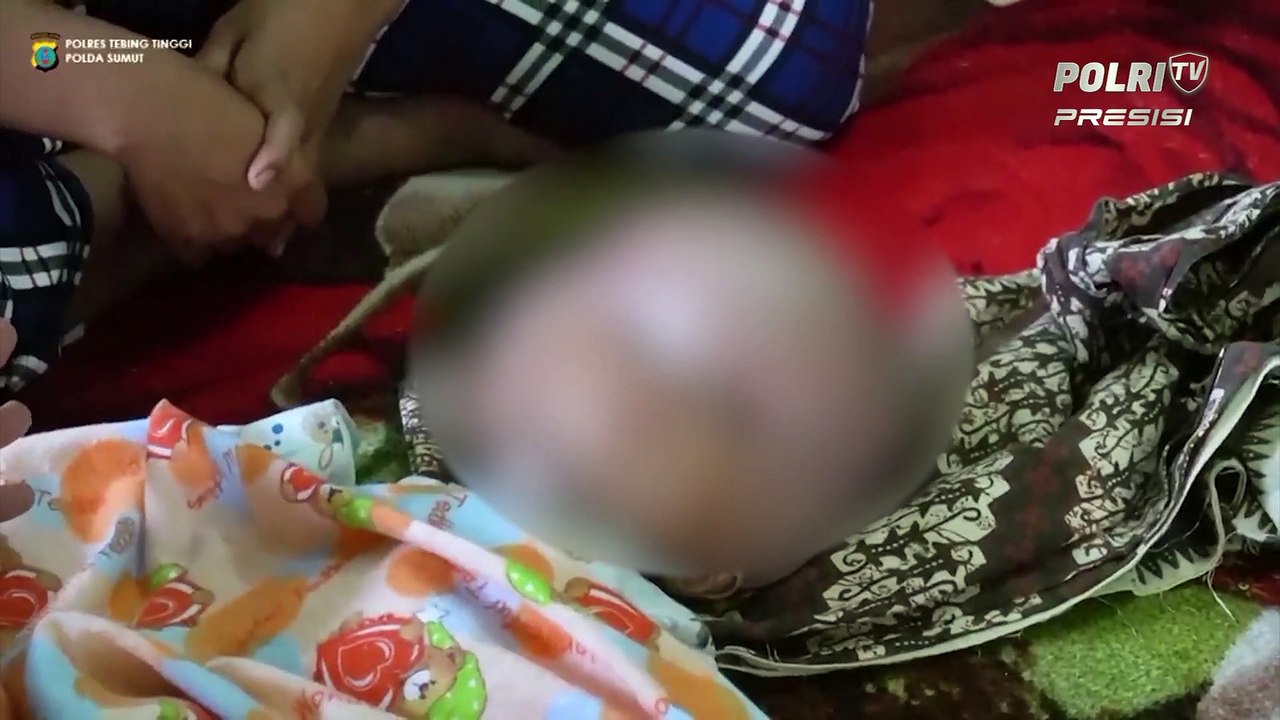 Berbagi Tali Asih, Kapolsek Tebing Tinggi Sambangi Balita Penderita Hidrosefalus