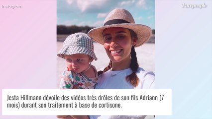 Jesta Hillmann et Benoît : leur bébé de 7 mois sous cortisone, un lourd traitement