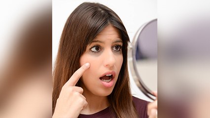 Dark Circles से जुड़ा ये सच जानकर चौंक जाएंगे आप | Types of Dark Circles | Boldsky
