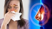 Nose की Bone बढ़ना है बेहद खतरनाक जानें Symptoms, कारण और उपाय । Boldsky