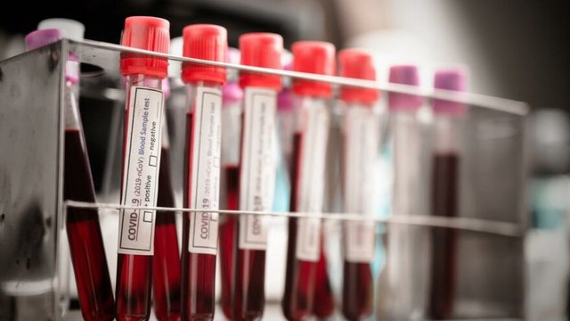 Mehmet Ceyhan: 'İki virüs aynı anda vücutta bulunabilir'