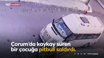 8 yaşındaki çocuğa pitbull saldırdı