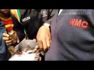 नाशिकमध्ये मांजामुळे जखमी झालेल्या कबुतराचे वाचवले प्राण