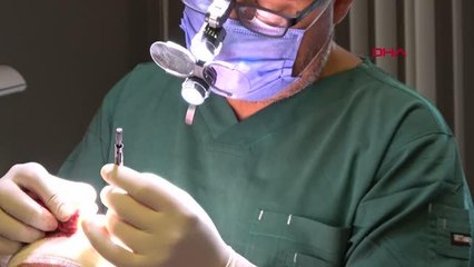 SAÇ EKİM MERKEZLERİ İÇİN KORKUTAN İDDİA SAÇ EKİM MERKEZLERİNİN YARISI DOKTORSUZ İŞLEM YAPIYOR