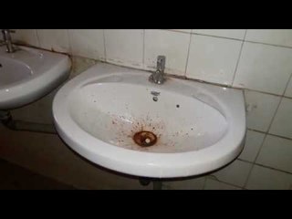 नाशिक पालिकेेच्या बेइज्जतीची पहिली घंटा !