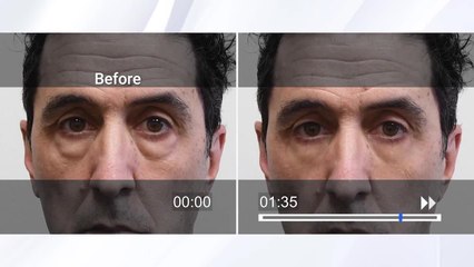 Getting older? Don't look your age by trying Plexaderm TODAY