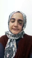 HDP'li Gergerlioğlu'ndan Adalet Bakanlığı'na Ayşe Özdoğan tepkisi: Adeta bir felaketi yaşayan bu kadına yapılan tüm vicdanları sızlatıyor