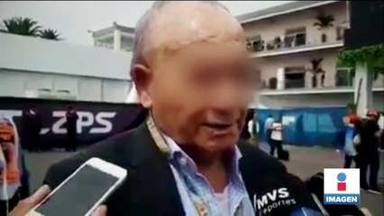 Billy "A" queda fuera de la Cooperativa Cruz Azul