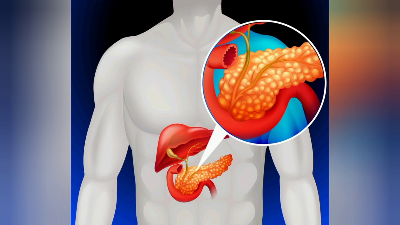 Type 1 Diabetes | Explained