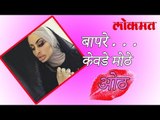 बापरे ! या महिलेचे ओठ अजब | OMG News In Marathi | Lokmat Marathi News | लोकमत मराठी न्यूज