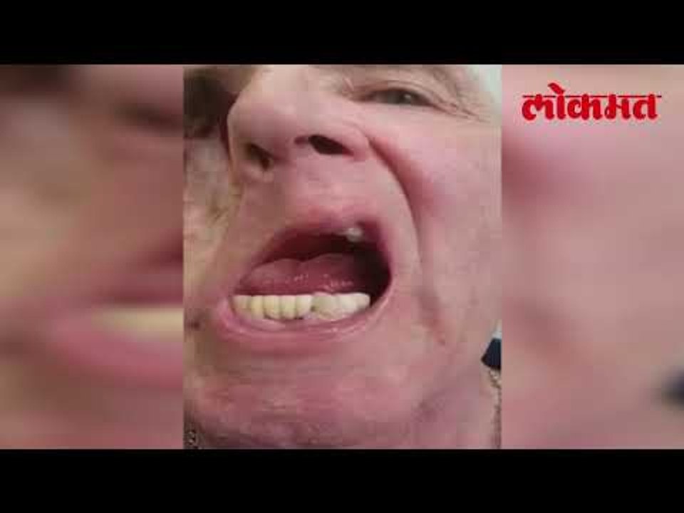 जिवंत माणसाने पहा केले खतरनाक काम | चेहऱ्यापासून वेगळे केले डोळे आणि दात | Lokmat News