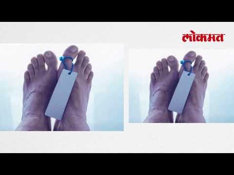 तो मेला आणि चक्क पोस्टमार्टम टेबल वर घोरू लागला.. | Lokmat Latest News Update | Lokmat News