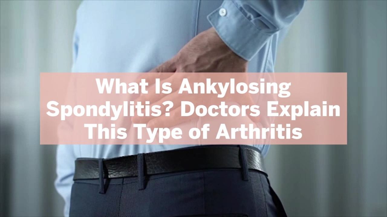 What Is Ankylosing Spondylitis? Doctors Explain...
