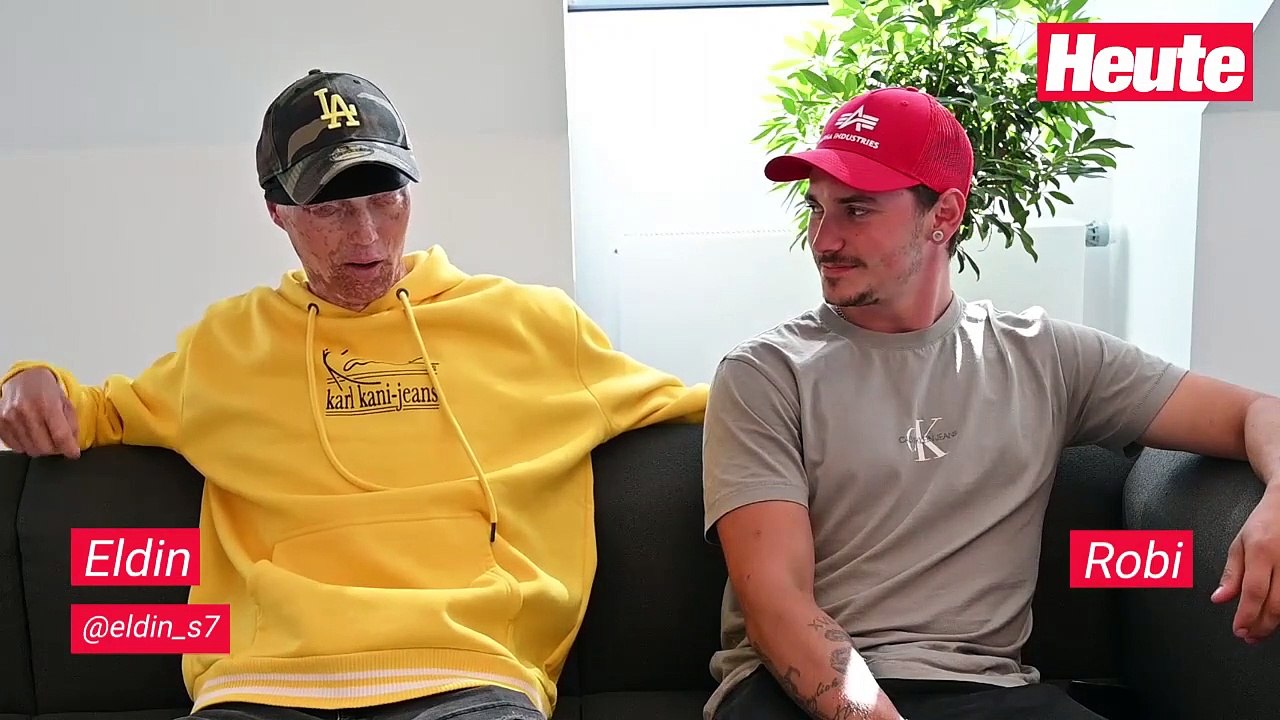 Blinder Österreich-Tiktoker: 'Brauche kein Mitleid!'