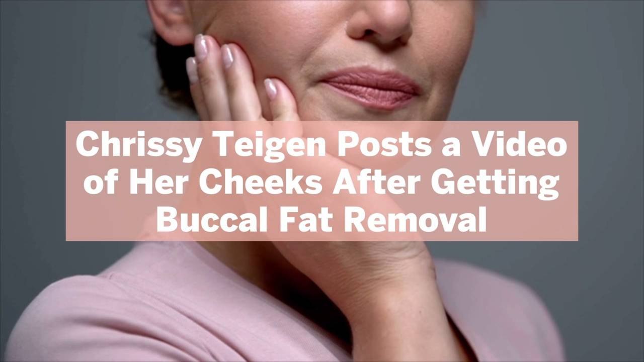 Chrissy Teigen Posts a Video of Her Cheeks After Getting Buccal Fat