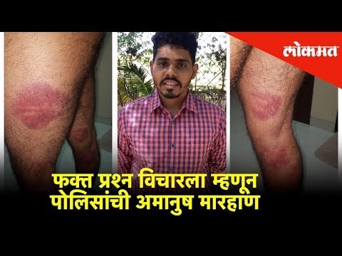 फक्त प्रश्न विचारला म्हणून तरुणाला पोलिसांनी अमानुष मारहाण | Lokmat News