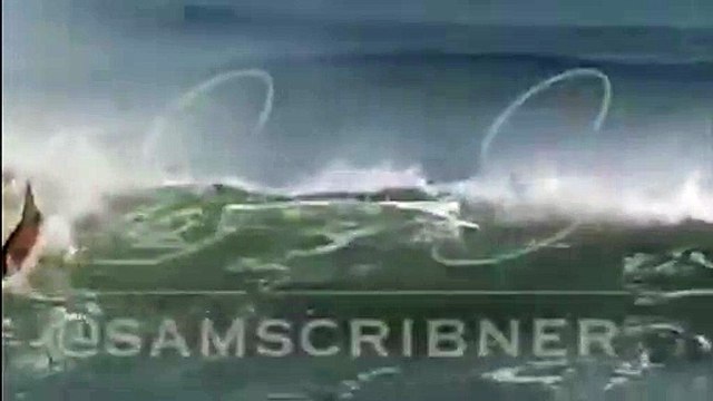 ABD'de sörf yapan çocuğun kolunu köpek balığı ısırdı