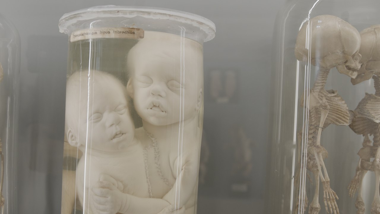 Narrenturm: Vom Gruselkabinett zum Vorzeigemuseum