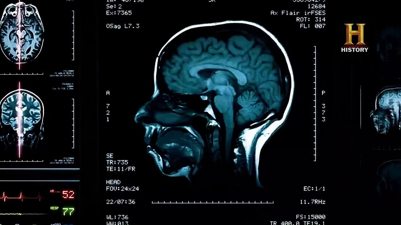 Unidentified - Die wahren X-Akten - Das sechste Merkmal