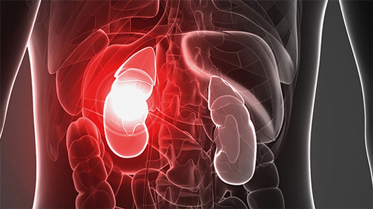 Kidney को बुरी तरह Damage करती है खाने की ये चीजें तुरंत बना लें दूरी । Boldsky