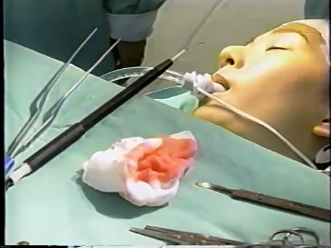 TRĂM NHỚ NGÀN THƯƠNG tập 1 ( Lâm Thoại Dương- Trương Ngọc Yến- Tiêu Ân Tuấn)