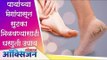 पायांच्या भेगांपासून सुटका मिळवण्यासाठी घरगुती उपाय Remove Cracked Heels Home Remedy | Lokmat Oxygen