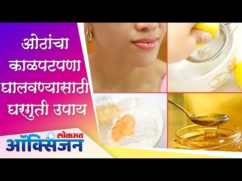ओठांचा काळपटपणा घालवण्यासाठी घरगुती उपाय | Lips Care | Lokmat Oxygen