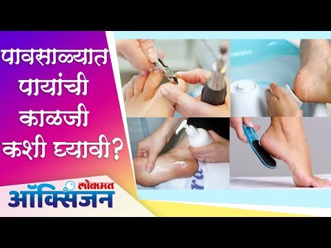 Monsoon Footcare Routine | Tips For Monsoon Skin Care | पावसाळ्यात पायांची काळजी कशी घ्यावी