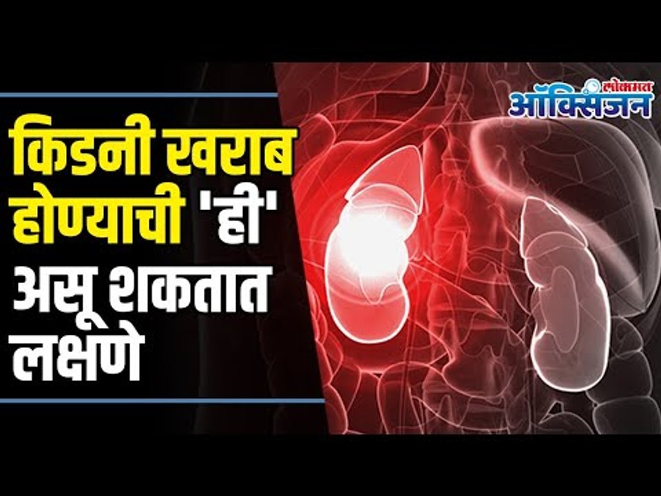 Symptoms of Kidney Failure I किडनी खराब होण्याची 'ही' असू शकतात लक्षणे | Lokmat Oxygen