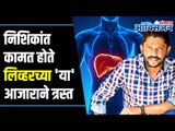 Nishikant Kamat passes away I What is liver cirrhosis? निशिकांत कामत होते 'या' आजाराने त्रस्त