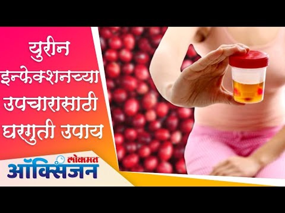 युरीन इन्फेक्शनच्या उपचारासाठी काही घरगुती उपाय | Home remedies | Urinary Infection | Lokmat Oxygen