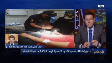 "إيده دخلت في مفرمة لحمة".. طوارئ طنطا الجامعي تنقذ "يد" شاب من مأساة البتر في 3 ساعات