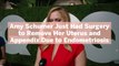 Amy Schumer Just Had Surgery to Remove Her Uterus and Appendix Due to Endometriosis
