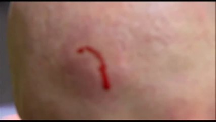 Agresión en directo a un reportero de informativos en Melbourne