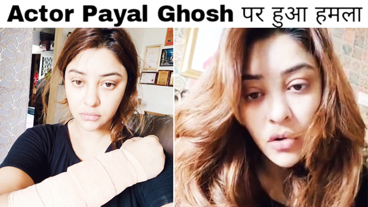 Payal Ghosh Attacked In Mumbai, Gets Injured