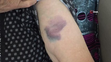 Oğlunun korkusundan uyuyamıyor... 26 yaşındaki şahıs hem annesi hem babaannesini dövüyor