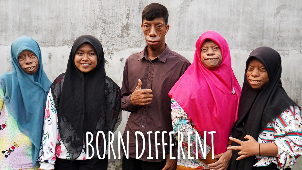 The Family Whose Faces Change Shape | BORN DIFFERENT - video Dailymotion