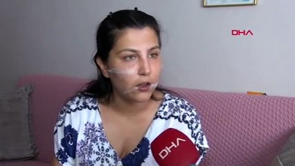 104 yerinden bıçakladığı eşinin başında sigara içmiş!