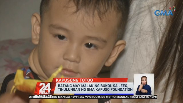 Batang may malaking bukol sa leeg, tinulungan ng GMA Kapuso Foundation | 24 Oras
