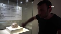 3 bin yıllık kafatasında bulunan ameliyat izi, görenlerin ilgisini çekiyor