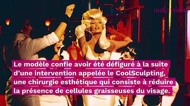 Linda Evangelista méconnaissable : elle révèle être défigurée par la chirurgie esthétique