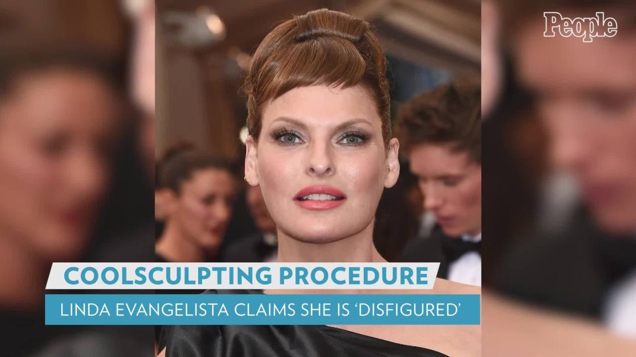 Supermodel Linda Evangelista Says Shes Been Brutally Disfigured By