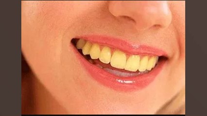 Teeth के जिद्दी पीलेपन को तुरंत करें White अपनाएं ये असरदार नुस्खा । How to Get Rid of Yellow Teeth