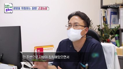충격적인 건강검진 결과!! 높은 간 수치와 지방간까지☠ TV CHOSUN 20210926 방송